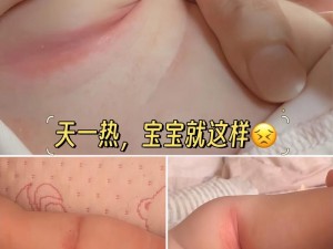 宝宝下面湿透还嘴硬疼是为什么？如何应对？