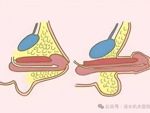 为什么男阳茎进女阳道视频要免费？有哪些方法可以找到它们？