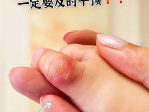 宝宝才两根手指就流了;宝宝才两根手指，为何就有液体流出？