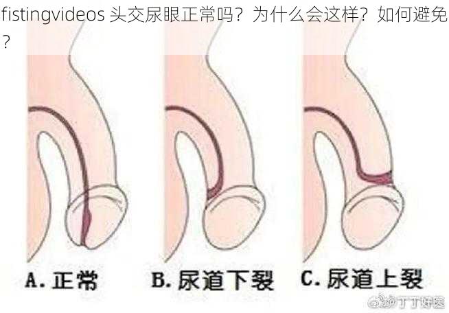 fistingvideos 头交尿眼正常吗？为什么会这样？如何避免？